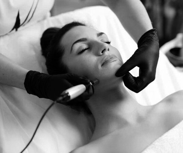 zaragoza dermapen facial zaragoza dermapen facial