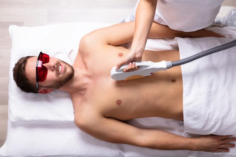 sesiones depilacion laser hombre