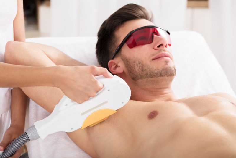 zonas depilacion laser hombres