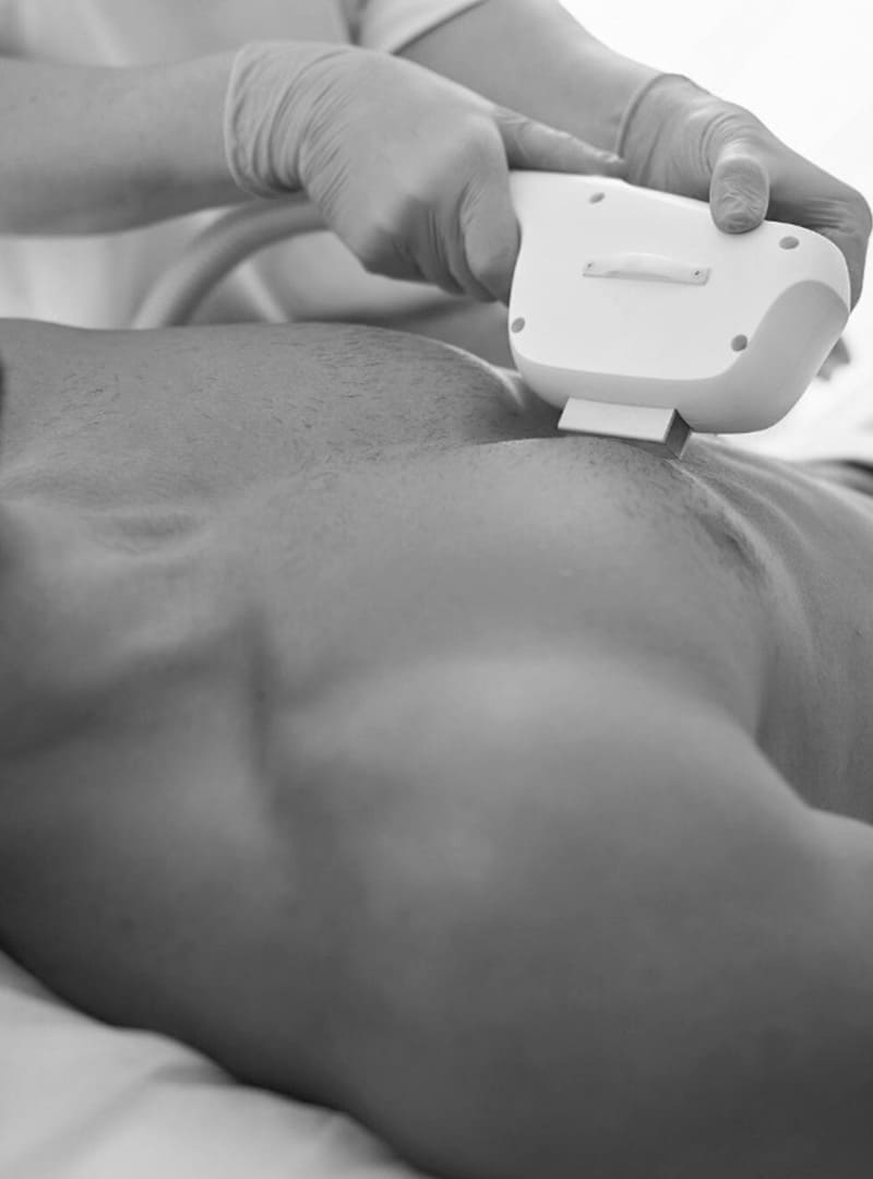 zaragoza centro depilacion laser