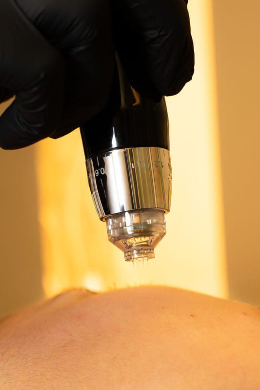 facial electroporacion zaragoza