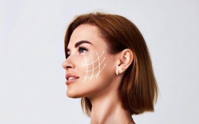 Armonización Facial: ¿Qué es y Cuáles son sus Beneficios?